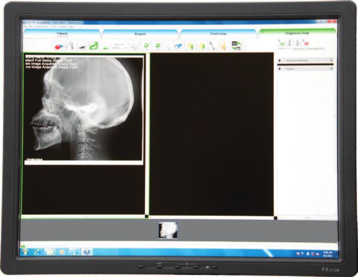 It s a panoramic X-ray that allows for in-office upgrades to Ceph or small fields of view 3D, as well as a patient that can be repositioned after the pan is acquired.