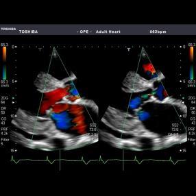 Medical Imaging: - Multi-slice CT - 3D Ultrasound -