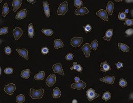 HoloMonitor M4 Holographic time-lapse imaging cytometry Quantitative Label-free