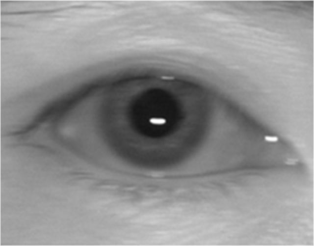 robust and efficient. Extensive experiments show that IDPR can improve accuracy and robustness of iris recognition systems and enlarge the effective capture range of iris recognition systems.