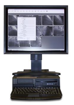 Diagnostic Medical Monitor LCD