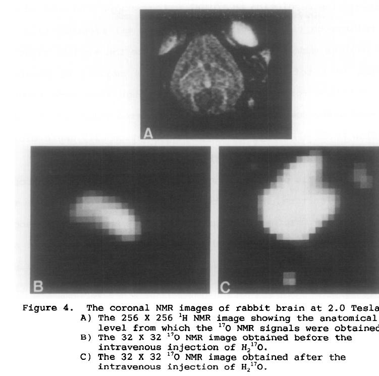 Imaging and results Acquisition parameters were used with one