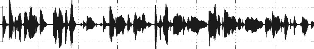 Part II 57 0.2 a The near-end signal x( n) -0.2 0.1-0.1 0.2 b The line echo signal l( n) c The far-end speech signal s( n) -0.