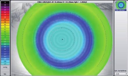 OxiMap visualizing the oxygen transmissibility Professional patient consultation The cornea needs oxygen and a good oxygen supply is fundamental for the comfort of a contact lens wearer.