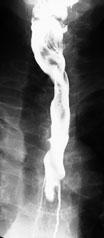 Examinations Supports radiographic esophageal examinations in the vertical