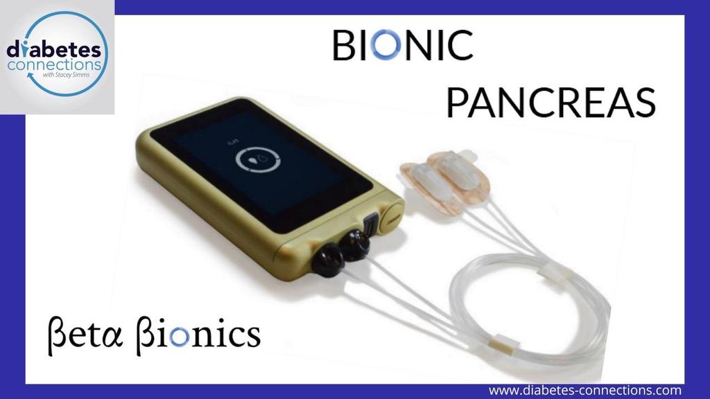 Bionic pancreas : Beta Bionics ilet (FDA trials began May 2018) Continuous