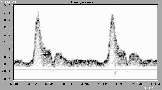frequency Spectral analysis Spectral analysis of the Doppler signal allows distinct frequency (velocity) contributions to be