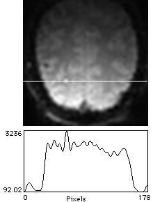 THE ACTUAL RESOLUTION OF fmri http://ccn.ucla.