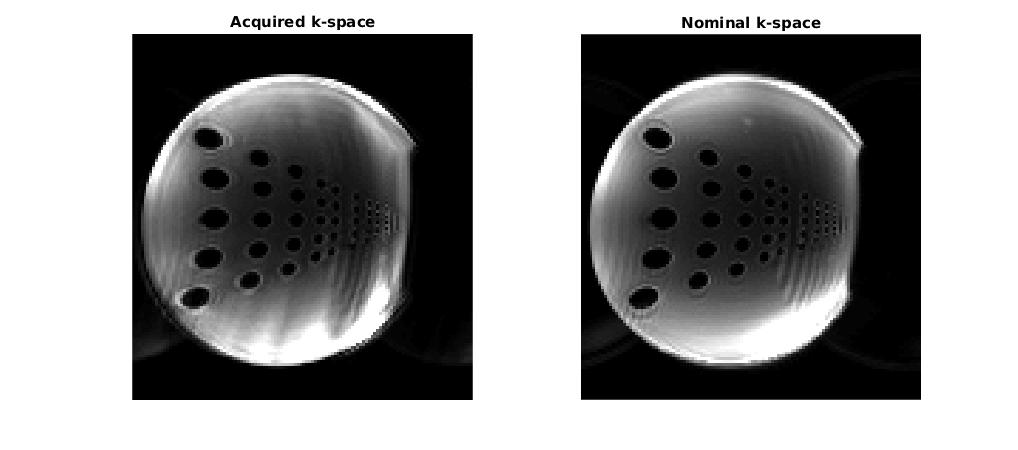 (recon) NUFFT reconstructed EPI images using acquired (left) and nominal (right) k-space trajectories.