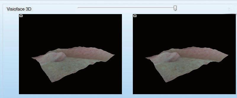wrinkles colour 3D-function pores spots Technical Data Dimensions: HWD 29.2 x 20.