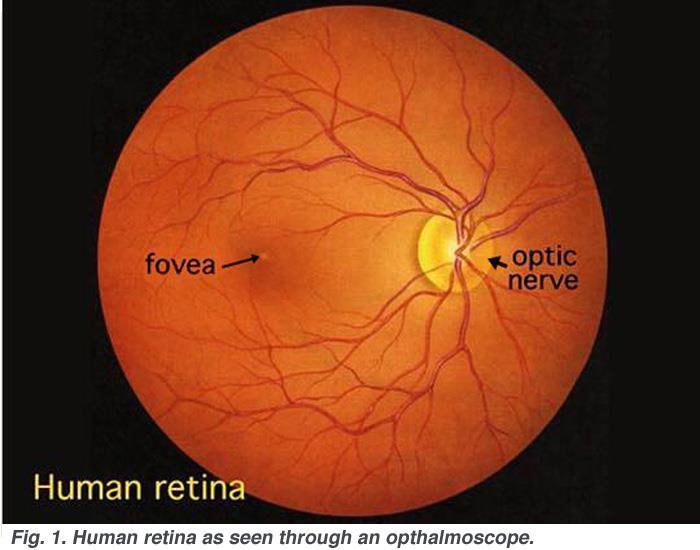 The Retina Diagram from