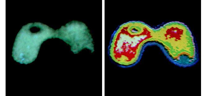 6.3.1 Intensity Slicing (a) (b) An X-ray image of the Picker Thyroid Phantom. After density slicing into 8 colors FIGURE 6.