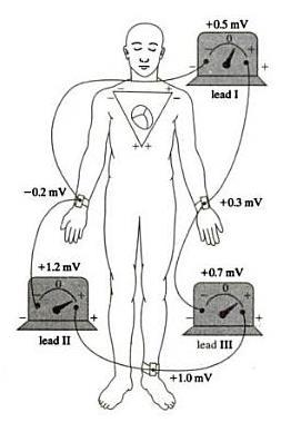 A standard arrangement of electrodes for an ECG is called