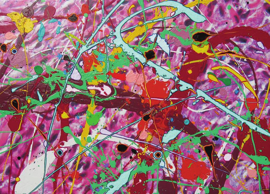 My Sarcoma #2, 2013 Acrylic, latex, and enamel on canvas printed with a photographic image of the metastatic sarcoma to my lung, 26