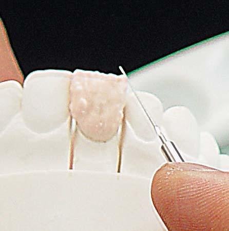 Metric scoops for dental