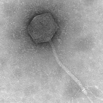 Images of phage in negative stain Electron microscopy Good contrast!