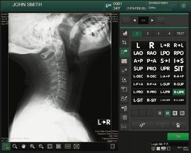 diagnostic images. An optional touch panel monitor ensures quick and accurate operation.