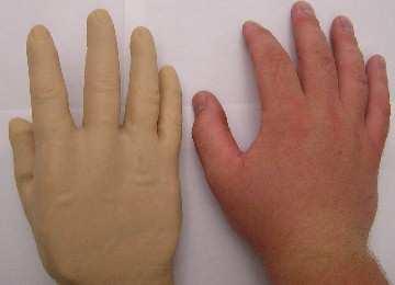 skin tones, the shape of artificial hand does mimic the human hand well, especially considering that