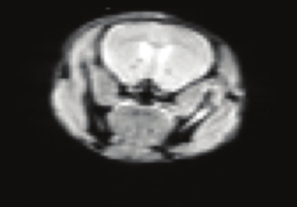 The conventional EPI (a) shows strong distortions and an inflated brain.