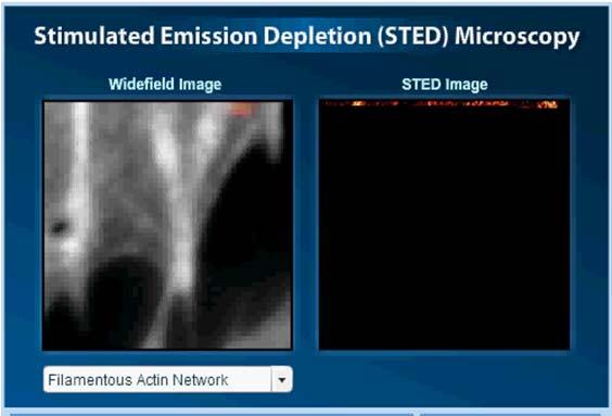 Stimulated emission depletion STED Configuration of microscope: Confocal laser