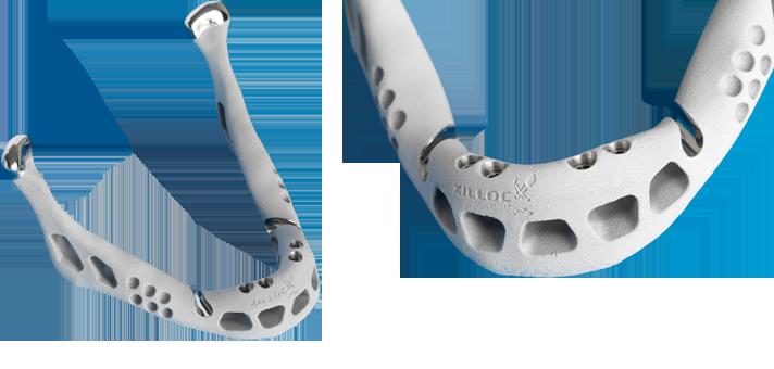 Protheses and dental & IP 3D printed jaw patentable?