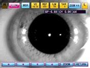 measurements even on patients who have intraocular lens implants.