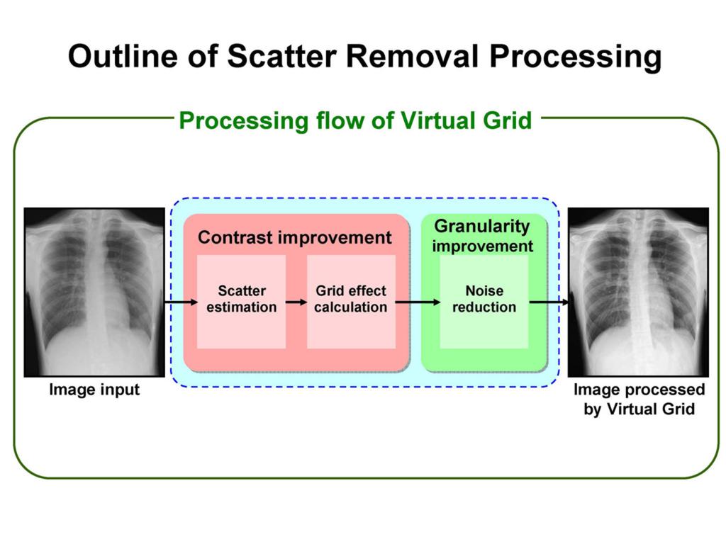 scattered x-ray in a ratio similar to a normal secondary radiation grid to improve image contrast.