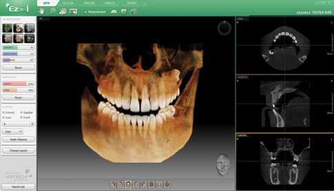PROFESSIONAL DIAGNOSTIC SOFTWARE EASY TO LEARN, EASY TO USE Ez3D-i will make your diagnosis easier and more professional.