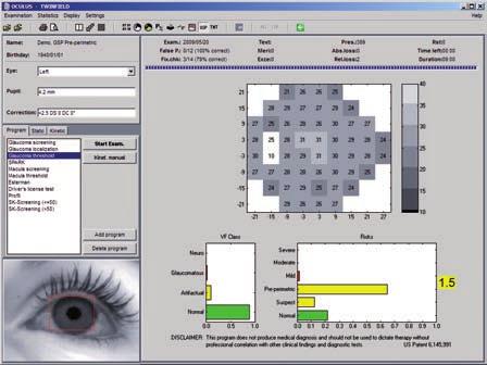 > GSP results display GSP classification is optimized to reproduce expert opinions on glaucoma.