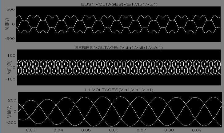 Fig.14 BUS1 voltage, series compensating voltage, and load voltage in Feeder1 under unbalanced source voltage.