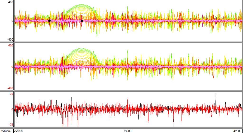 The middle panel illustrates the same channels after the despiking filter has been applied. The bottom panel compare the last channel only of the unfiltered data (black) and the despiked data (red).