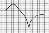otch depth is variable from 5-5 db. Pass and notch frequencies must be known so that the optimum loop assembly can be used.