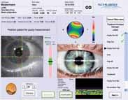 This ensures that you always know exactly how much you have already ablated and how thick the remaining cornea actually is, which increases the intraoperative safety in refractive treatments.