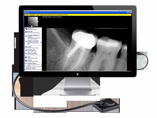 Advanced Design Noise Reduction The new white face plate design provides the administrator an easy target for capturing excellent x-rays