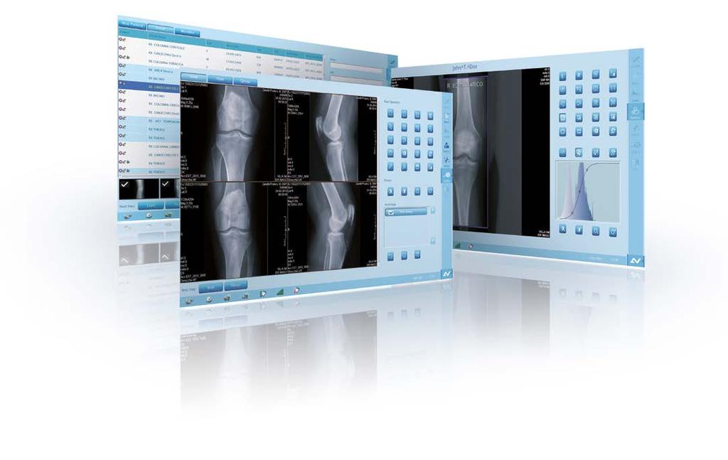 system enhancing the diagnostic content DROC acquisition software All VDX panels are controlled from an acquisition and processing workstation equipped with powerful DROC imaging software, designed