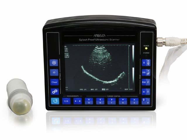 AV-2100 Splash Proof Mechanical Ultrasound Scanner APPLICATION RANGE This device is suitable in hospitals and clinics for diagnosing liver, GB, spleen, kidney, pancreas, heart, bladder, uterus.