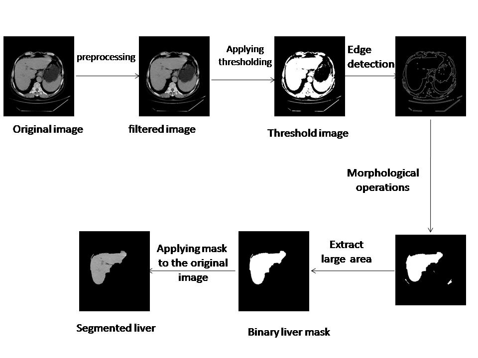 Segmentation of Liver CT Images M.A.Alagdar 1, M.E.Morsy 2, M.M.Elzalabany 3 1,2,3 Electronics And Communications Department-.Faculty Of Engineering Mansoura University, Egypt.
