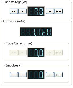 Dental Older intra-oral machines don t set exposure time in conventional units, but set the number of impulses. Each impulse is a single mains voltage cycle. In the UK this is 0.
