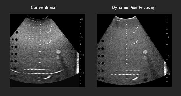 DPF has been proved by both phantom and real clinical images.