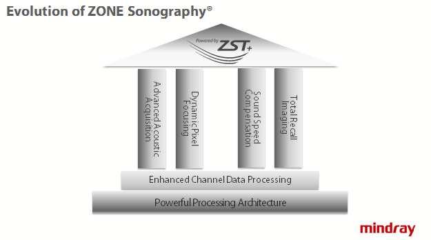 eliminates repeat scanning. All is the core pillars for ZST +. Besides four pillars, ZST + has also been evolved based on ZONE Sonography.
