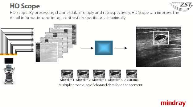 HD Scope is one of the outstanding evolved technology based on channel data.
