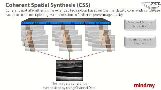 Coherent spatial synthesis is another innovative technology based on channel data to coherently synthesize each pixel from multiple-angle transmission to further improve image quality.