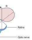 Exp II/Mechanical Stimulation of the Retina Explain that stimulation of nasal retina will give image in the temporal field and vice versa.