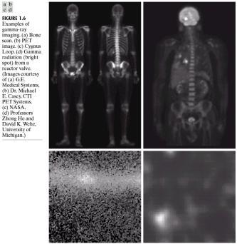 Computerized tomography (CT) Using X-rays Bone scan