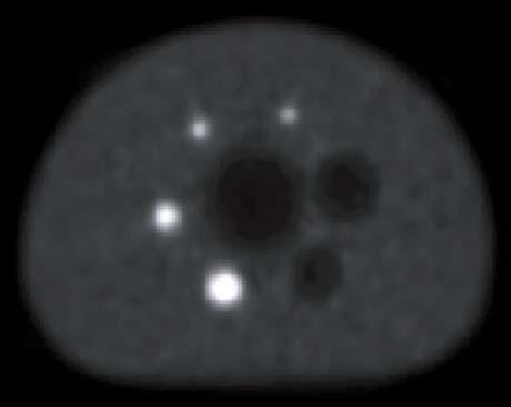 Gaussian filter with FWHM of 5 mm. Images are given in Fig. 7 for the N=8 and N=4 activity concentration ratios.