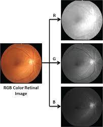 making use of the green channel histogram of the fundus image. The method used an approximation of the area occupied by optic disc in most retinal images.