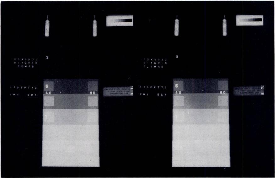 VOL. 117, No. Evaluation of Roentgenography of tile Chest 775 11G. 8. Roentgenograms of phantom: 105 kvp, 10 mas, 8:i grid; 115 kvp, 7.5 mas, 8 :i grid.