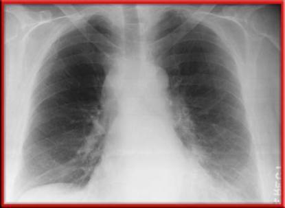 X Rays λ ten billionths to ten trillionths of a meter Doctors use low doses of X rays to form