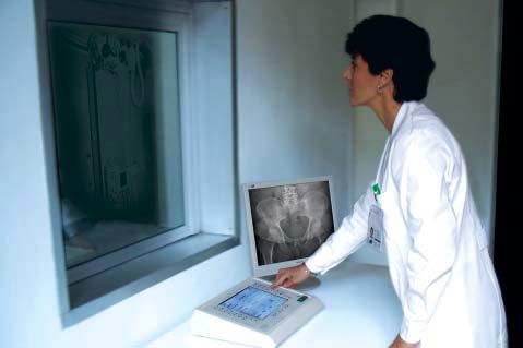 ITALRAY DR solutions Filmless operation is the future of radiology and ITALRAY DR SOLUTIONS (Digital Radiography) are the cornerstone of a networked department where high quality X-ray images are