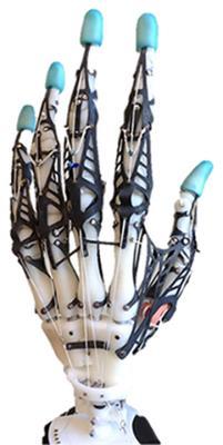 highly biomimetic anthropomorphic robotic hand towards artificial limb